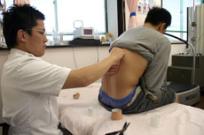 キネシオテーピング